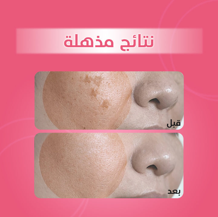 Dark Spot Corrector