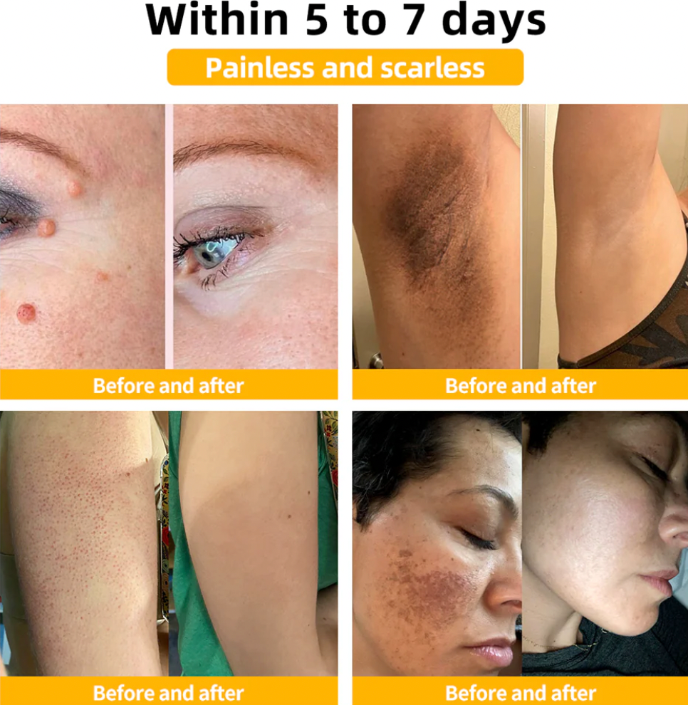 Bee Venom Skin Elixir